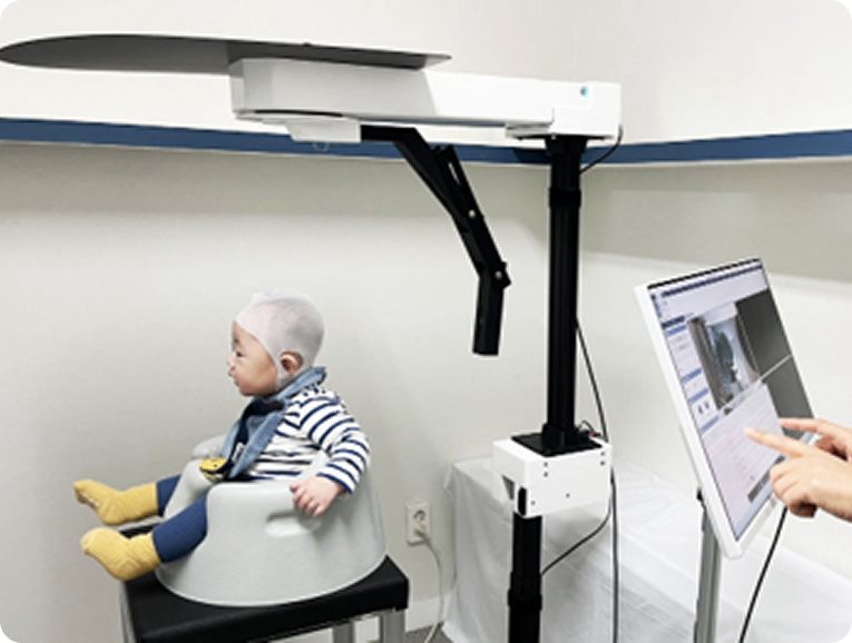 MS320H 3D scanner scanning a baby's head