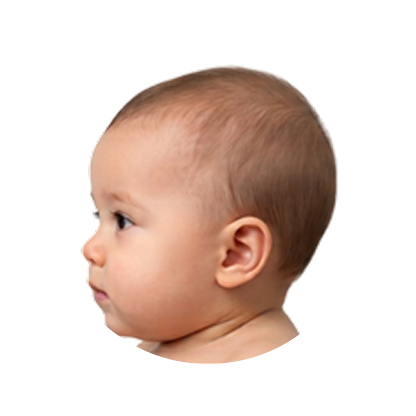 Normal brachycephaly