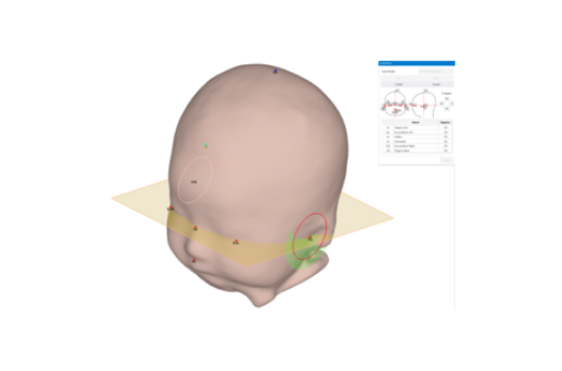 3D head shape scanning and measurement