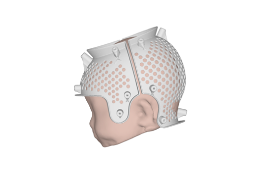 Custom corrective shell design