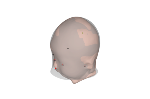 3D rectification model