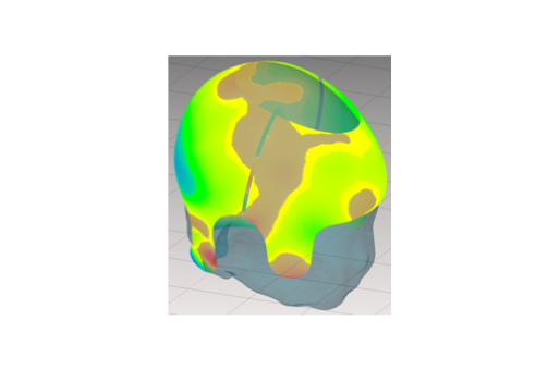 Volumetric growth analysis